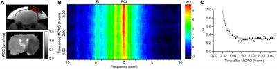 Magnetic Resonance pH Imaging in Stroke – Combining the Old With the New